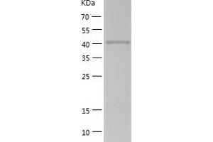 Western Blotting (WB) image for Proline-serine-threonine Phosphatase Interacting Protein 1 (PSTPIP1) (AA 1-416) protein (His tag) (ABIN7124597)