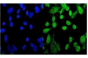 IF analysis of MED9 using anti-MED9 antibody (ABIN5519032).