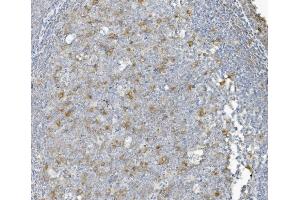 IHC analysis of CCNB1 using anti-CCNB1 antibody (ABIN7599335). (Cyclin B1 anticorps  (AA 1-383))