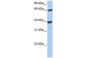 TKT antibody used at 1 ug/ml to detect target protein. (TKT anticorps)