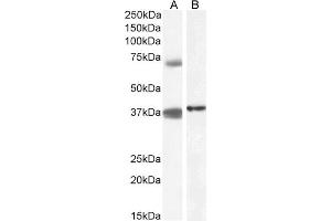 ABIN571104 (1µg/ml) staining of Peripheral Blood Mononucleocyte (A) and (0. (TRIM29 anticorps  (Internal Region))