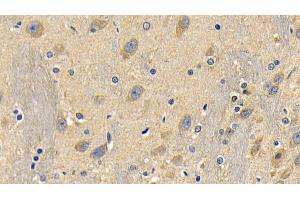 Detection of RIPK1 in Rat Cerebrum Tissue using Polyclonal Antibody to Receptor Interacting Serine Threonine Kinase 1 (RIPK1)