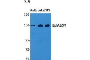 Western Blot (WB) analysis of specific cells using EphA2/3/4 Polyclonal Antibody. (EPHA2/3/4 anticorps  (Lys14))