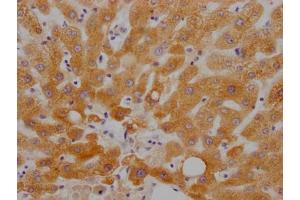 IHC image of ABIN7127790 diluted at 1:100 and staining in paraffin-embedded human liver tissue performed on a Leica BondTM system. (Recombinant RBP4 anticorps)
