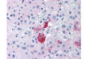 Anti-EPHX2 antibody IHC of human adrenal.