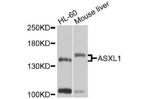 Western blot analysis of extracts of various cell lines, using ASXL1 antibody (ABIN6003622) at 1/1000 dilution. (ASXL1 anticorps)