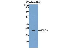 Western Blotting (WB) image for anti-Gastrokine 1 (GKN1) (AA 53-192) antibody (ABIN1859011) (Gastrokine 1 anticorps  (AA 53-192))
