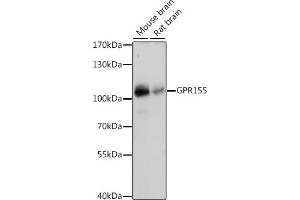 Western blot analysis of extracts of various cell lines, using GPR155 antibody (ABIN7267298) at 1:1000 dilution. (GPR155 anticorps  (AA 721-870))