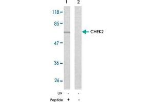 Western blot analysis of the extracts from Jurkat cells using CHEK2 polyclonal antibody  . (CHEK2 anticorps)