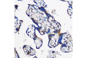 Immunohistochemistry of paraffin-embedded Human placenta using EY Rabbit pAb (ABIN6135167, ABIN6140386, ABIN6225031 and ABIN6225033) at dilution of 1:100 (40x lens). (EYA1 anticorps  (AA 100-250))