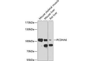 Western blot analysis of extracts of various cell lines, using PCDH antibody (ABIN6128584, ABIN6145301, ABIN6145302 and ABIN6220787) at 1:1000 dilution. (PCDHA6 anticorps  (AA 1-230))