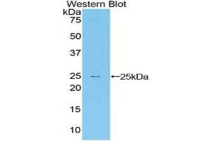 Western Blotting (WB) image for anti-Sprouty Homolog 1, Antagonist of FGF Signaling (SPRY1) (AA 118-309) antibody (ABIN1860620)