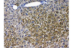 IHC analysis of Cytochrome P450 2D6 using anti- Cytochrome P450 2D6 antibody .
