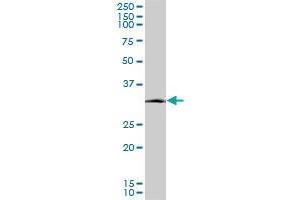 SIX3 monoclonal antibody (M08), clone 2B9. (SIX3 anticorps  (AA 273-332))