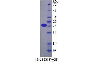 SDS-PAGE analysis of Mouse OPA3 Protein.