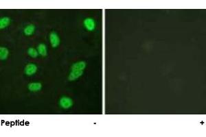 Immunofluorescence analysis of HeLa cells, using MYBL2 polyclonal antibody .