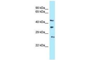 Image no. 1 for anti-U6 SnRNA Biogenesis 1 (USB1) (AA 150-199) antibody (ABIN6747953) (C16orf57 anticorps  (AA 150-199))