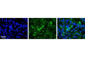 Rabbit Anti-WBAntibody     Formalin Fixed Paraffin Embedded Tissue: Human Pineal Tissue  Observed Staining: Cytoplasmic in cell bodies of pinealocytes and their processes  Primary Antibody Concentration: 1:100  Other Working Concentrations: 1/600  Secondary Antibody: Donkey anti-Rabbit-Cy3  Secondary Antibody Concentration: 1:200  Magnification: 20X  Exposure Time: 0.