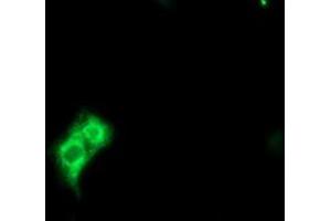 Image no. 7 for anti-Methionyl Aminopeptidase 2 (METAP2) (AA 2-212) antibody (ABIN1491153) (METAP2 anticorps  (AA 2-212))