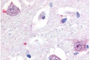 Anti-ROR Beta antibody  ABIN1049296 IHC staining of human brain, thalamus. (RORB anticorps  (Hinge Region))