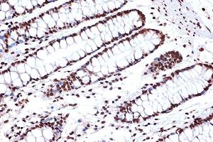 Immunohistochemistry of paraffin-embedded human colon using FUBP1 Rabbit mAb (ABIN7267128) at dilution of 1:100 (40x lens). (FUBP1 anticorps)