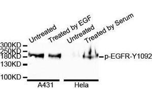 Western Blotting (WB) image for anti-Epidermal Growth Factor Receptor (EGFR) (pTyr1068) antibody (ABIN3020070)
