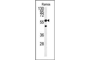 PHGDH Antibody (Center) (ABIN650767 and ABIN2839544) western blot analysis in Ramos cell line lysates (15 μg/lane). (PHGDH anticorps  (AA 249-277))