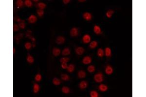 ABIN6266725 staining COS7 by IF/ICC. (TADA2L anticorps)