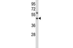 PDCD4 antibody western blot analysis in HL-60 lysate.