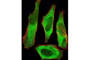 Fluorescent image of Hela cells stained with XAF1 Antibody (C-term) (ABIN6242701 and ABIN6577426).