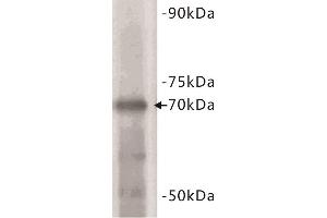 Western Blotting (WB) image for anti-Estrogen Receptor 1 (ESR1) (C-Term) antibody (ABIN1854892) (Estrogen Receptor alpha anticorps  (C-Term))