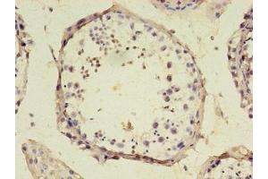 Immunohistochemistry of paraffin-embedded human testis tissue using ABIN7168967 at dilution of 1:100 (SRSF1 anticorps  (AA 1-183))