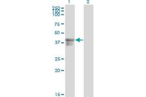 Western Blot analysis of SERPINB3 expression in transfected 293T cell line by SERPINB3 monoclonal antibody (M01), clone 2F5. (SERPINB3 anticorps  (AA 276-390))