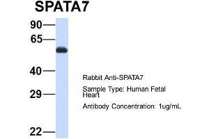 Host: Rabbit  Target Name: SPATA7  Sample Tissue: Human Fetal Heart  Antibody Dilution: 1. (SPATA7 anticorps  (Middle Region))
