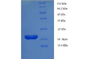 SDS-PAGE (SDS) image for Fragile Histidine Triad (FHIT) (AA 2-150) protein (His tag) (ABIN5711223)