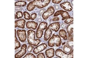 Immunohistochemical staining of human kidney with DNAJC16 polyclonal antibody  shows strong cytoplasmic positivity in cells in tubules at 1:50-1:200 dilution. (DNAJC16 anticorps)