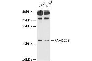 Western blot analysis of extracts of various cell lines, using FB antibody (ABIN7267107) at 1:1000 dilution. (FAM127B anticorps  (AA 1-113))