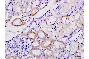 Formalin-fixed and paraffin embedded mouse kidney tissue labeled with Anti-Galectin-9 Polyclonal Antibody , Unconjugated at 1:200, followed by conjugation to the secondary antibody and DAB staining
