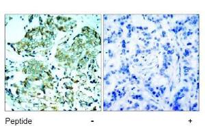 Image no. 1 for anti-Epidermal Growth Factor Receptor (EGFR) (Tyr1110) antibody (ABIN197516)