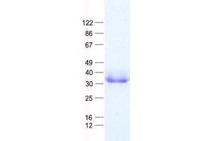 Validation with Western Blot