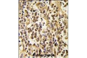 Formalin-fixed and paraffin-embedded human kidney tissue reacted with the primary antibody, which was peroxidase-conjugated to the secondary antibody, followed by DAB staining. (DNMT3A anticorps  (AA 457-486))
