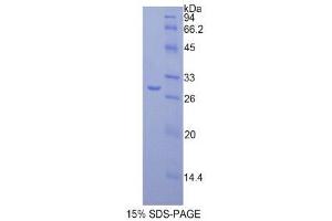 SDS-PAGE (SDS) image for Fatty Acid Synthase (FASN) (AA 2257-2504) protein (His tag) (ABIN2121015)