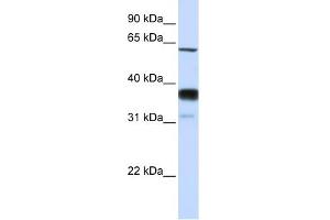 SMPD3 antibody used at 1 ug/ml to detect target protein. (SMPD3 anticorps)