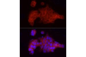 Immunofluorescence analysis of MCF7 cells using VEGFR3/FLT4 Rabbit pAb (ABIN6130779, ABIN6140698, ABIN6140701 and ABIN6217251) at dilution of 1:100 (40x lens). (FLT4 anticorps  (AA 1174-1363))