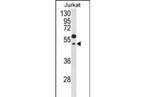 Western blot analysis of GNAT1 Antibody (C-term) (ABIN653740 and ABIN2843042) in Jurkat cell line lysates (35 μg/lane). (GNAT1 anticorps  (C-Term))