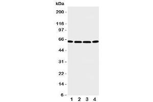Western blot testing of P2X6 antibody and Lane 1:  U87 (P2RX6 anticorps  (C-Term))