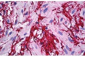 Human Prostate, Extra Cellular Matrix: Formalin-Fixed, Paraffin-Embedded (FFPE)