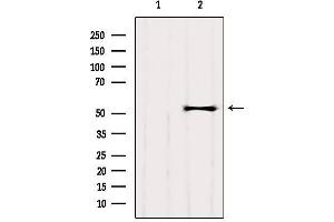 Western blot analysis of extracts from HepG2, using GPR89A Antibody.