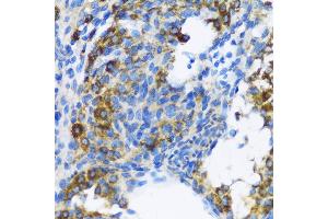 Immunohistochemistry of paraffin-embedded Rat ovary using PTCH1 antibody (ABIN1682368, ABIN1682367, ABIN3015342, ABIN3015343 and ABIN6213997) at dilution of 1:100 (40x lens). (Patched 1 anticorps  (AA 1214-1312))