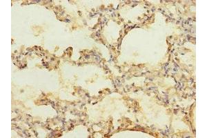 Immunohistochemistry of paraffin-embedded human lung tissue using ABIN7175581 at dilution of 1:100 (CACNA2D2 anticorps  (AA 20-200))